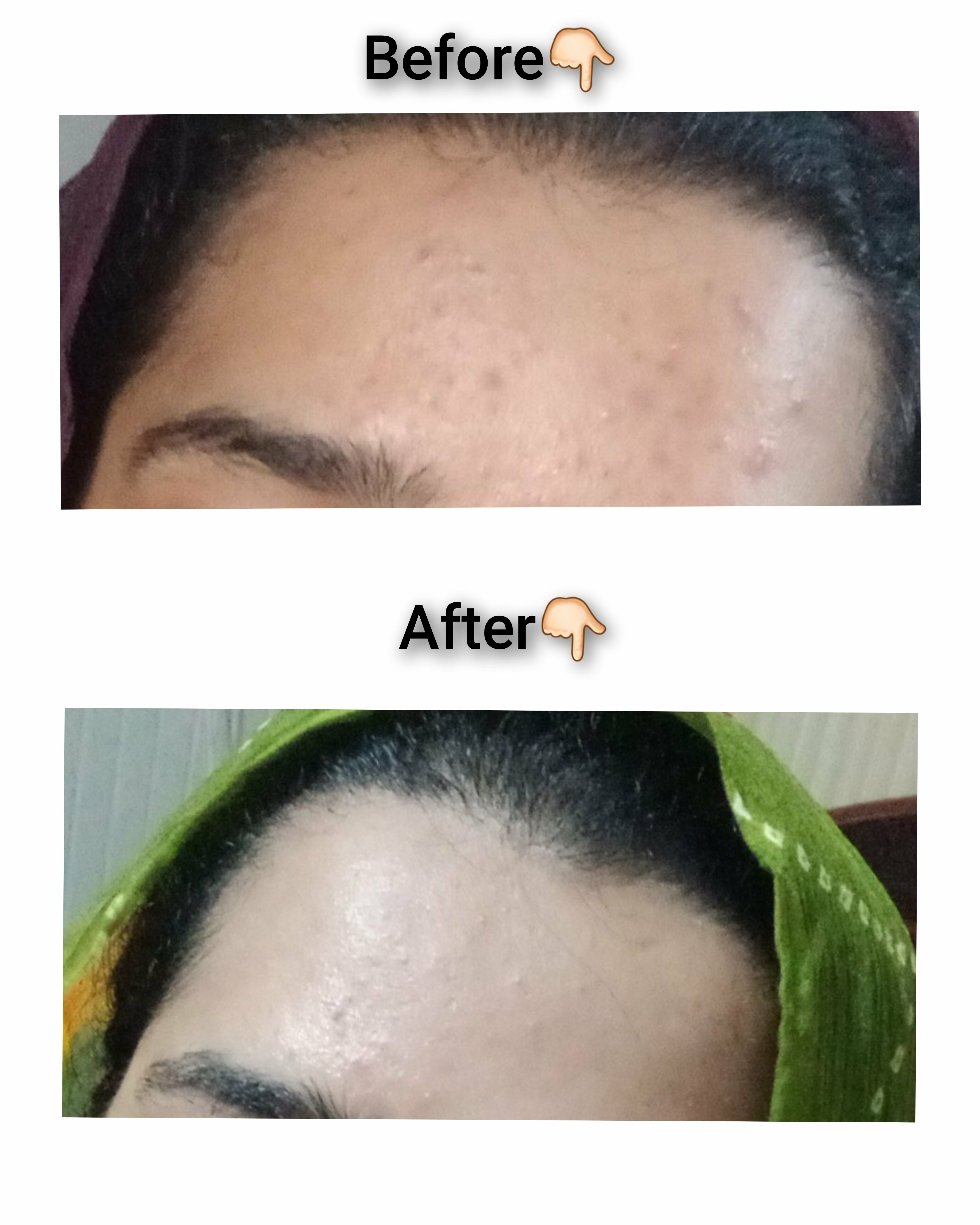 Review attachment slider image 1 from Mahnoor on July 24, 2025